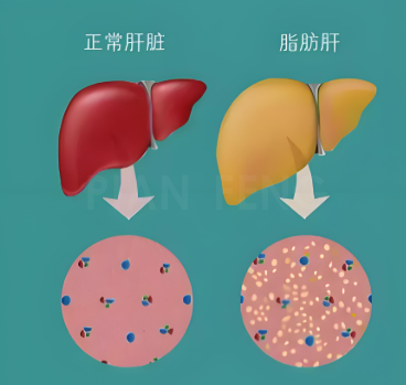 科普文章代写作案例|【世界肝炎日】科普肝脏“求救信号”，别让你的身体发动机告急(图5)